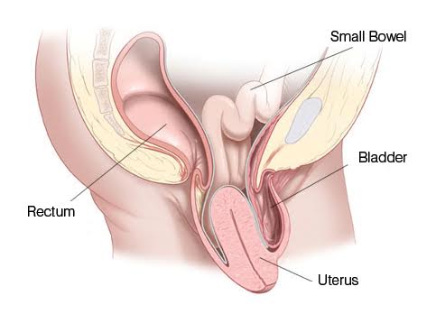 Uterine Prolapse Are you - River's Natural Health Domain