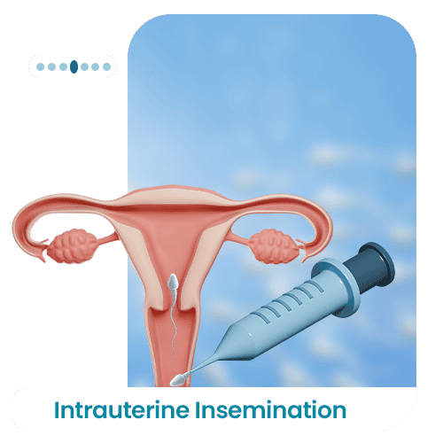 Intrauterine-Insemination