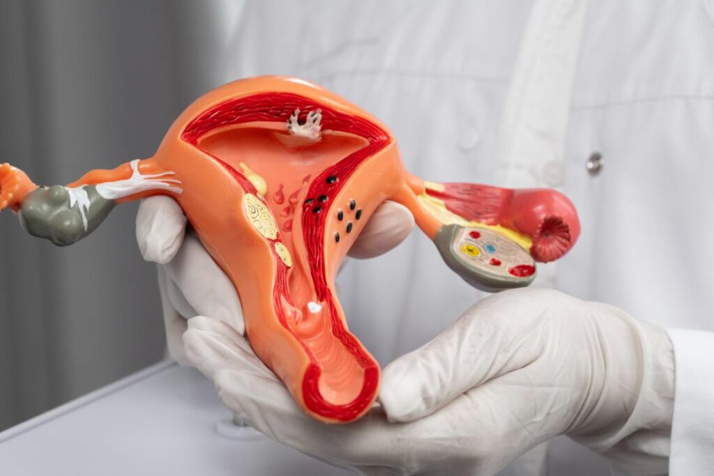 Normal Ovary Sizes Right vs. Left